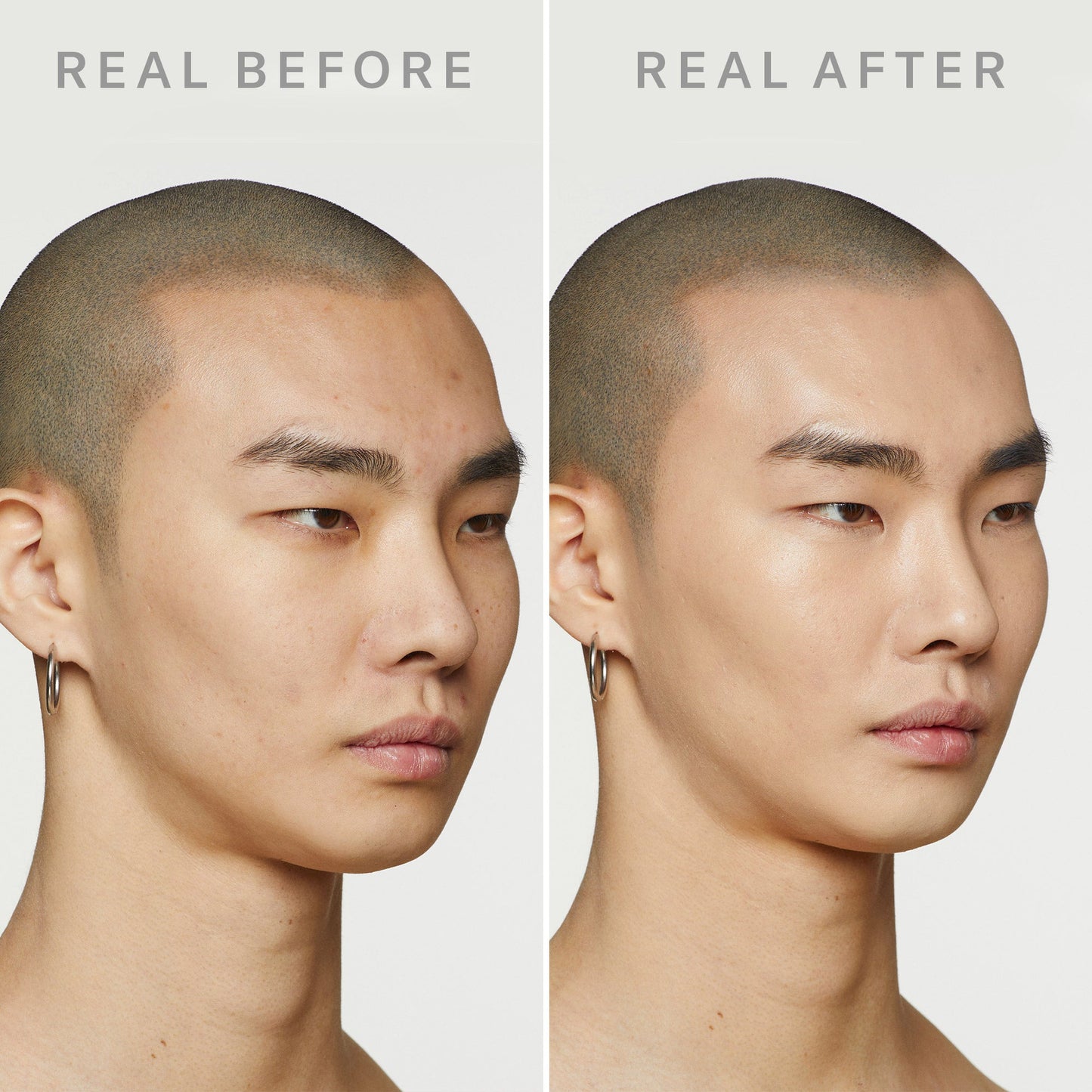 DEW SHIELD - BB CREAM & SKIN CARE in 1